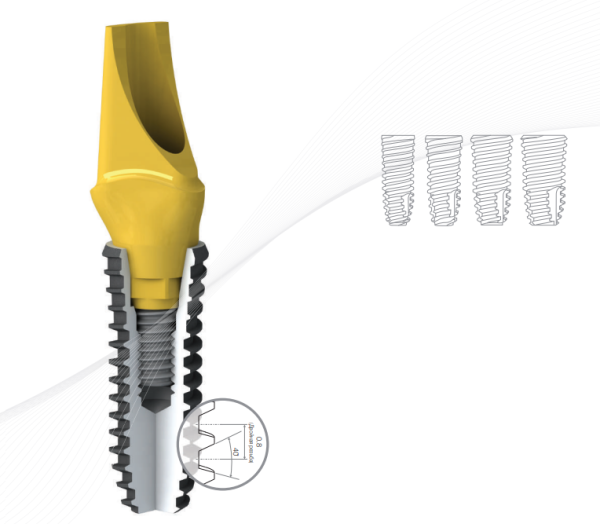 Имплантат s-Clean OneQ-SL, Regular Type (cтандартный тип) Dentis Co., Ltd., Южная Корея