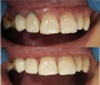 Camouflage (8) Megadenta Dentalprodukte, Германия