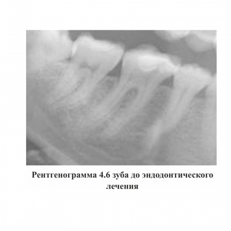 Ceraseal Meta Biomed, Южная Корея