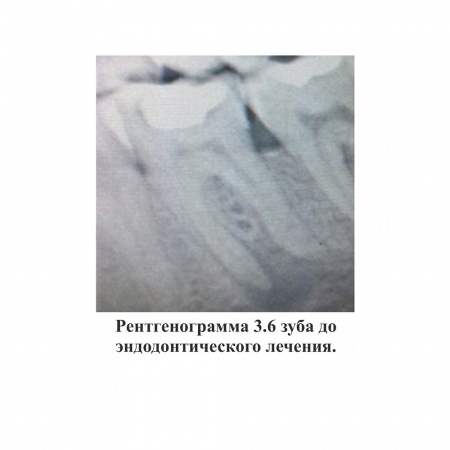 Ceraseal Meta Biomed, Южная Корея